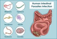 Common causes of parasite symptoms in humans